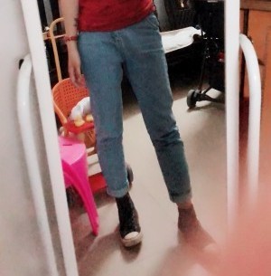 胖腿女孩兒福利分享：吸脂瘦大腿的蛻變，效果值得點贊！