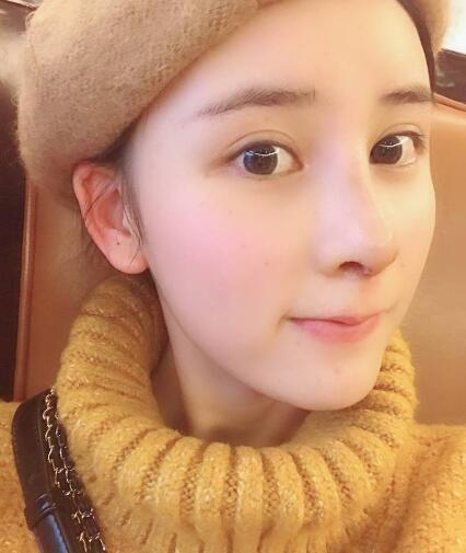 北京哪家隆鼻好？花一萬鼻子做成這樣值不值