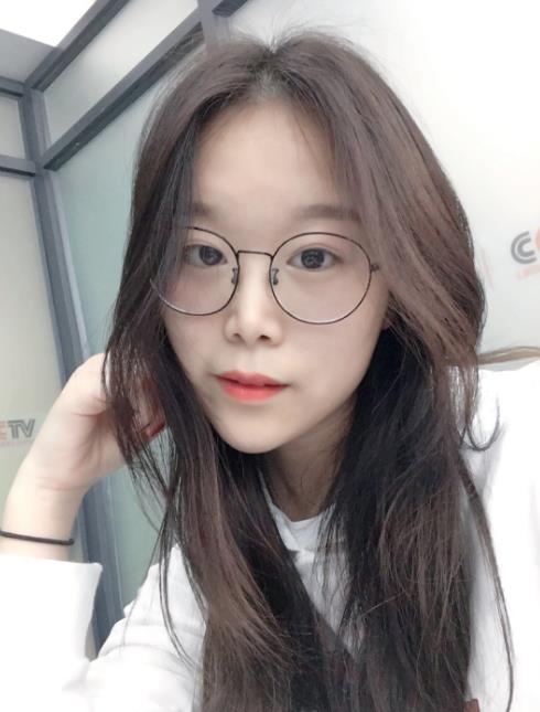 石家莊諾萬(wàn)整形肋軟骨隆鼻案例術(shù)后兩個(gè)月效果