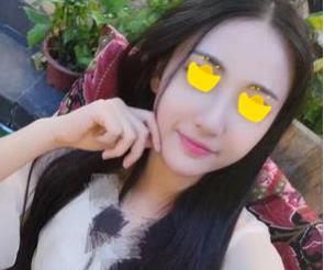 深圳鵬愛做隆鼻手術(shù)兩個月效果