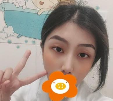 救命，周杰群做的耳軟骨隆鼻恢復(fù)后鼻背線條也太好看了吧