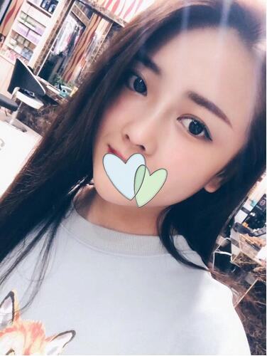 廈門海峽整形鼻綜合案例分享，這鼻子可以滑滑梯了