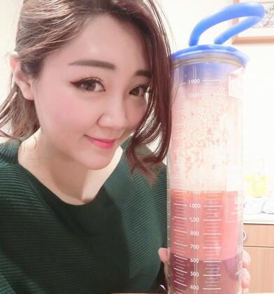 揭陽美萊整形手臂吸脂案例分享，輕松告別拜拜肉