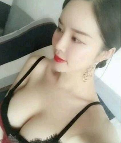 福州海峽假體隆胸案例術(shù)后兩個(gè)月 福州海峽假體隆胸案例術(shù)后兩個(gè)月