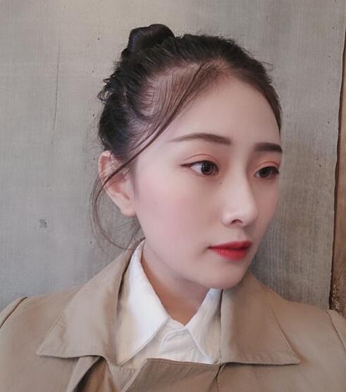 杭州時(shí)光磨骨案例術(shù)后三個(gè)月效果