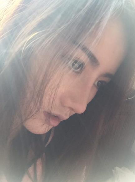 北京藝美整形鼻綜合案例術(shù)后一個月 北京藝美整形鼻綜合案例術(shù)后一個月