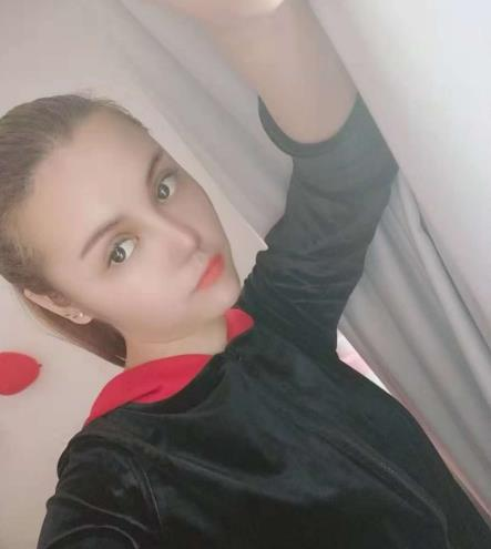 長沙雅美眼鼻整形案例分享，術(shù)后這滿滿的混血感是腫么回事