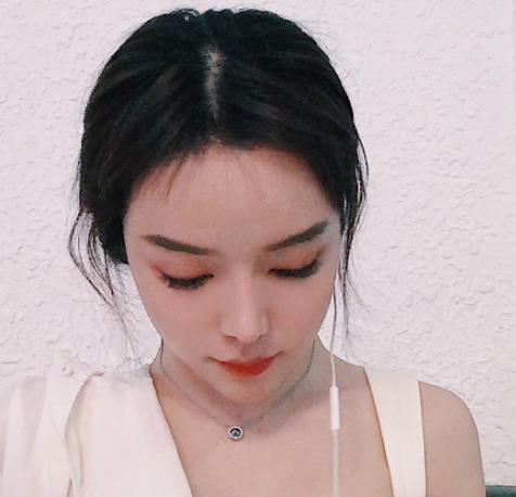 廈門新生植發(fā)種植發(fā)際線三個月 廈門新生植發(fā)種植發(fā)際線三個月