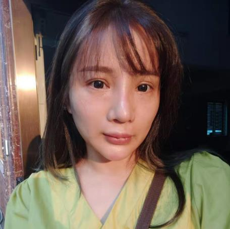 天津文怡整形水光針效果分享，化出來的好皮膚不如真的好皮膚