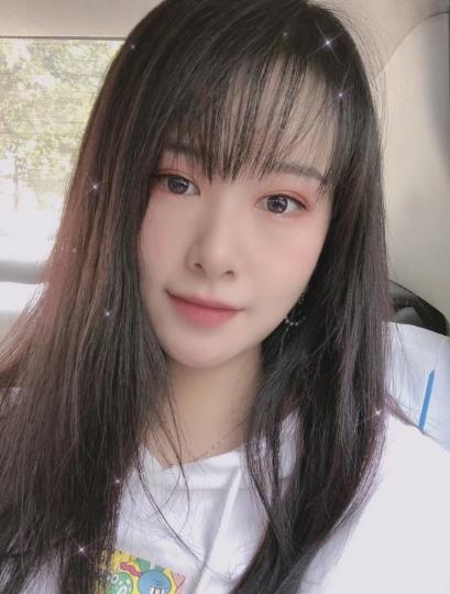 南方醫(yī)院整形美容科顴骨內推一個月