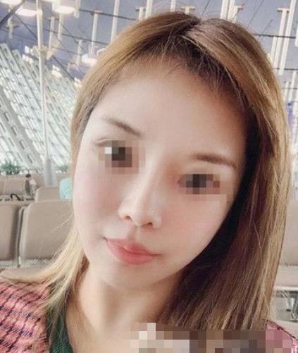 南京閱顏整形瘦臉針注射后半個月 南京閱顏整形瘦臉針注射后半個月