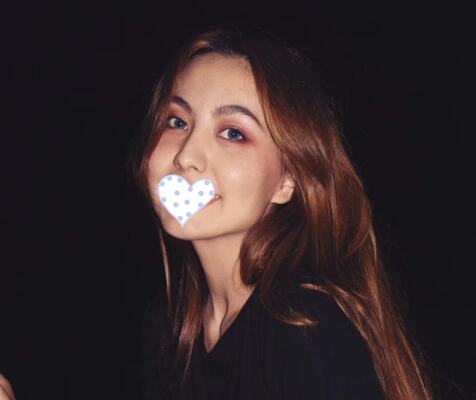 徐州時光洪揚整形雙眼皮術后三個月效果