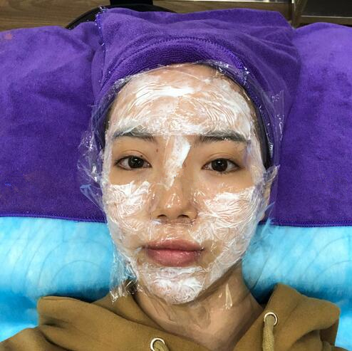 合肥艾雅整形紅藍(lán)光祛痘第二個(gè)療程治療中