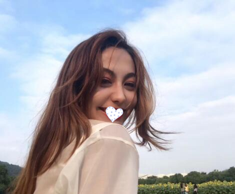 徐州時光洪揚整形雙眼皮術后兩個月效果