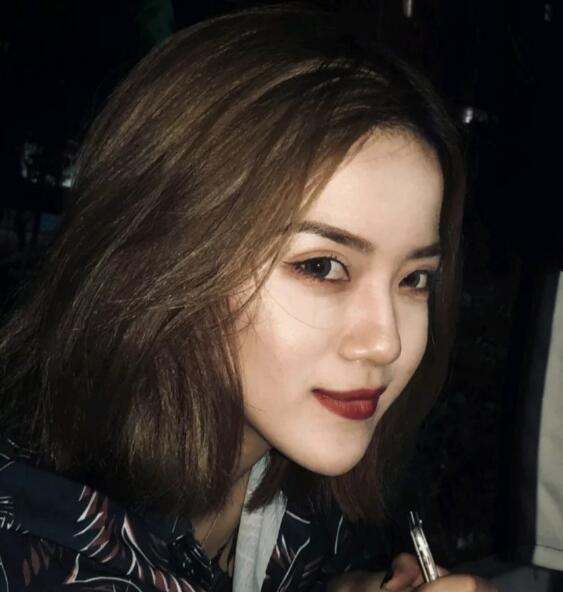 重慶華美下頜角整形術(shù)后兩個(gè)月效果 重慶華美下頜角整形術(shù)后兩個(gè)月效果