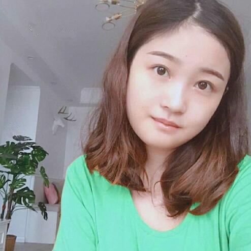 重慶美聯(lián)臣下頜角整形一個(gè)月效果