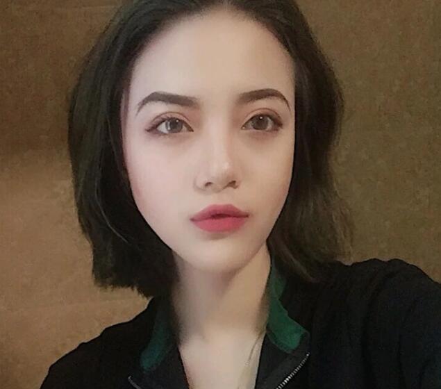 重慶華美下頜角整形術(shù)后一個(gè)月效果 重慶華美下頜角整形術(shù)后一個(gè)月效果