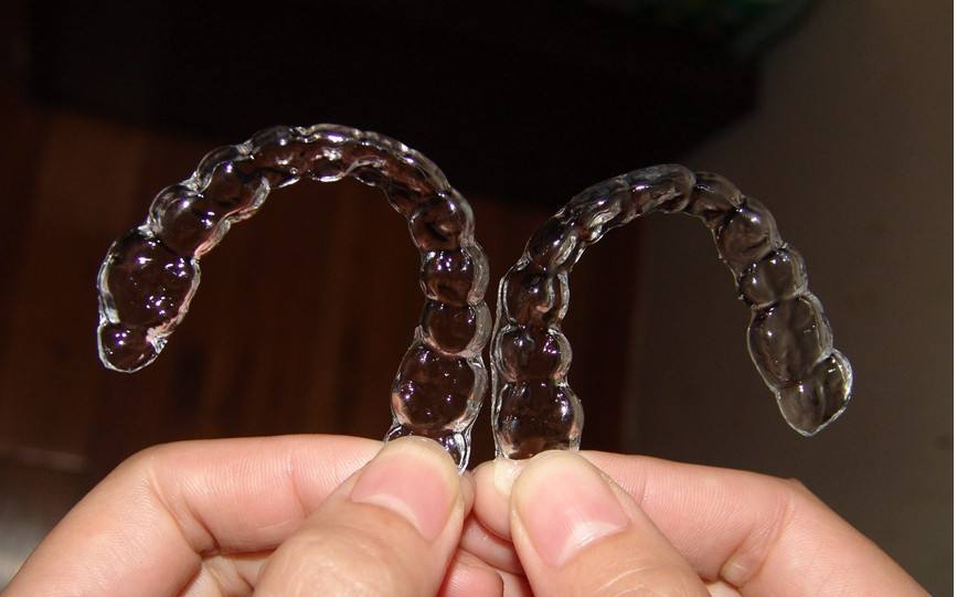 自貢華醫(yī)整形金屬托槽矯正結(jié)束，佩戴保持器