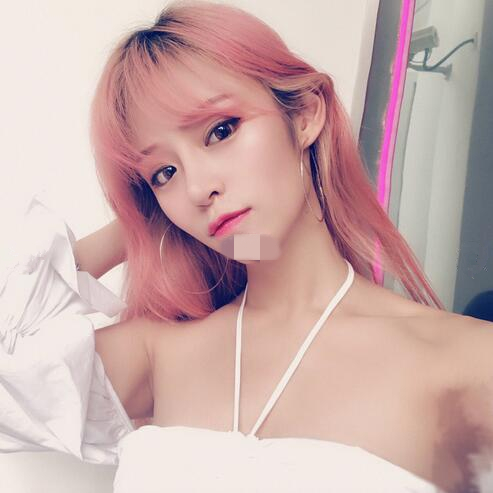 北京崔相平整形雙眼皮修復(fù)兩個(gè)月效果