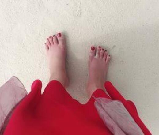 大同和平燒傷骨科醫(yī)院整形美容科大腳骨矯正術(shù)后三個月效果 大同和平燒傷骨科醫(yī)院整形美容科大腳骨矯正術(shù)后三個月效果