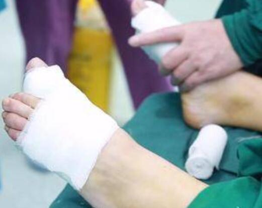 大同和平燒傷骨科醫(yī)院整形美容科大腳骨矯正術(shù)后當(dāng)天 大同和平燒傷骨科醫(yī)院整形美容科大腳骨矯正術(shù)后當(dāng)天