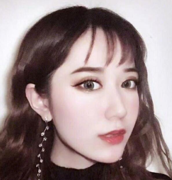 上海藝星整形崔海天下頜角整形術后三個月效果 上海藝星整形崔海天下頜角整形術后三個月效果