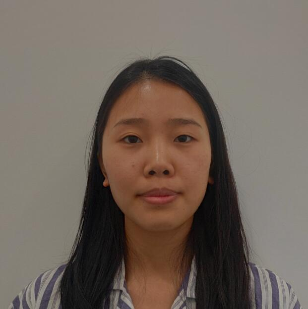 煙臺華怡整形張上海切開雙眼皮案例分享