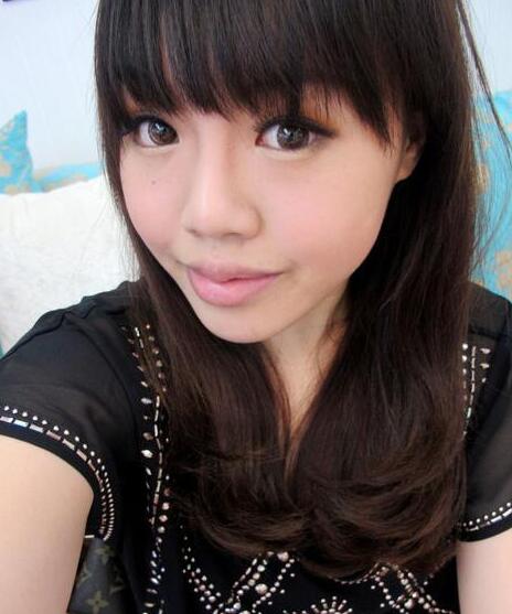 杭州藝涵整形玻尿酸豐唇后效果