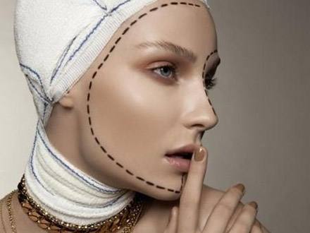 東北國(guó)際醫(yī)院整形下頜角整形術(shù)后效果