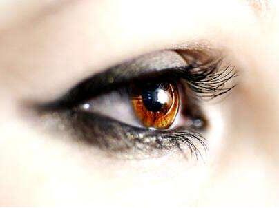 福州愛(ài)爾美整形美容醫(yī)院雙眼皮術(shù)后效果