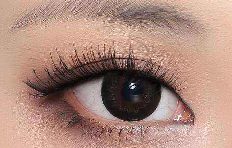 福州新時代美容雙眼皮術(shù)后效果