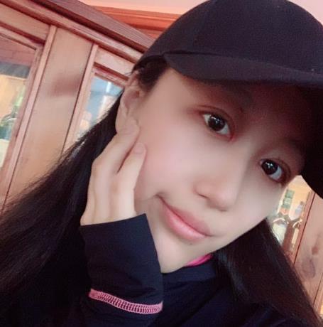 上海華美楊亞益做眼部修復(fù)案例效果對比圖