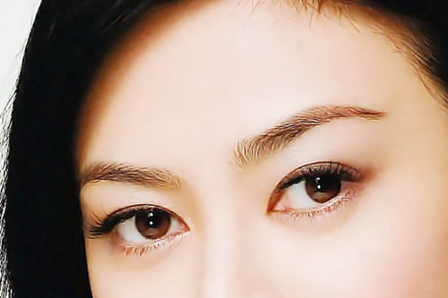 懷化華美美萊整形開眼角