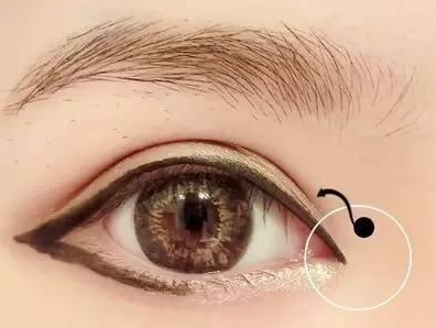 黃岡皇氏醫(yī)療美容醫(yī)院開(kāi)眼角