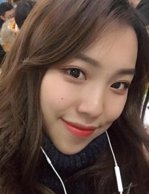 下頜角截骨完全恢復(fù)后的效果