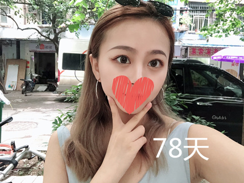 5-2003241F602T8.jpg 5-2003241F602T8.jpg