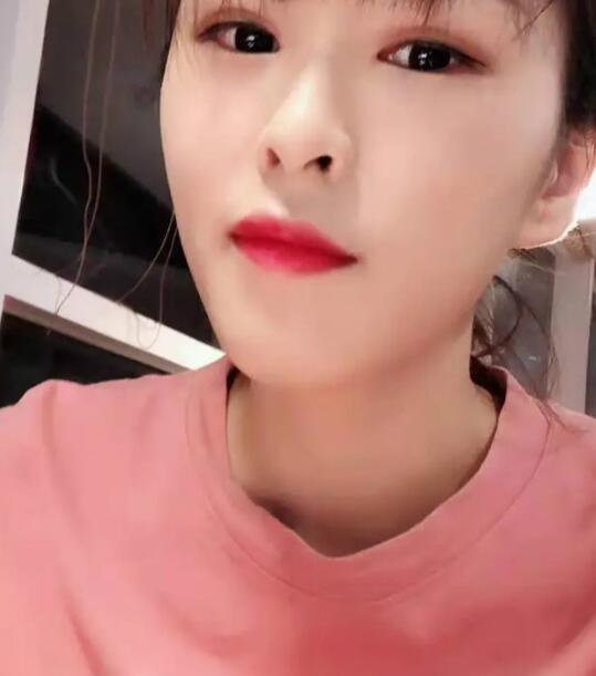 激光祛斑恢復(fù)期 激光祛斑恢復(fù)期