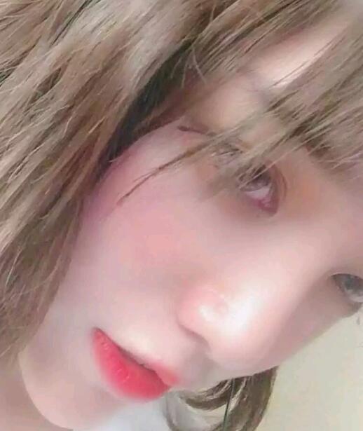 注射隆鼻恢復(fù)中 注射隆鼻恢復(fù)中