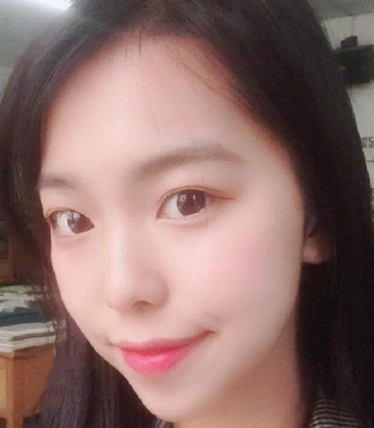 下頜角截骨手術(shù)后