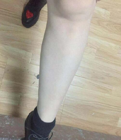 宋君醫(yī)生激光脫毛手術(shù)最終效果圖對比