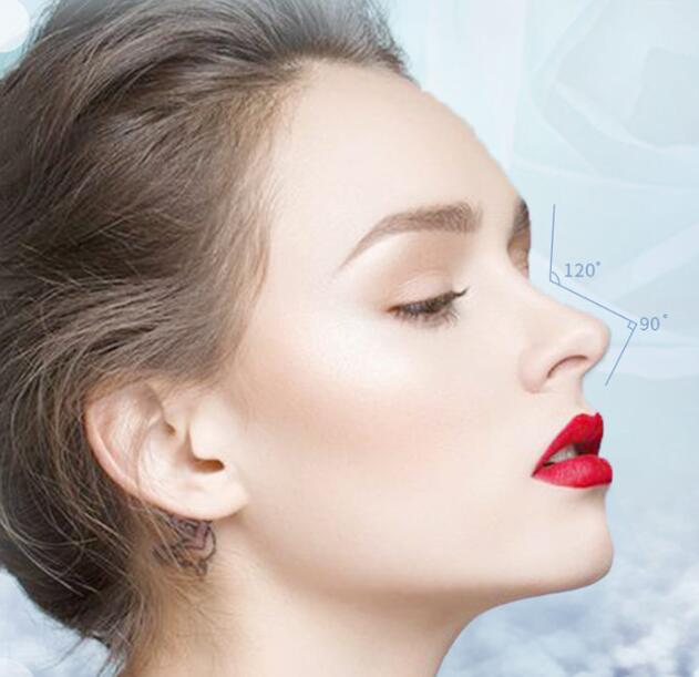 北京博士園整形醫(yī)生郭以文假體隆鼻修復(fù)案例