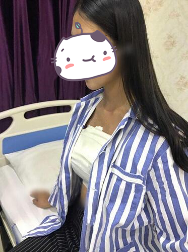 北京冰蝶醫(yī)療整形張克旭琴面假體隆胸案例，隆胸效果對(duì)比圖