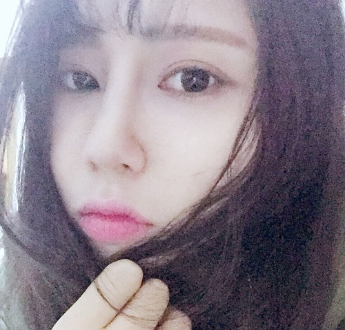 滄州瑞美醫(yī)療美容門診部王波醫(yī)生鼻骨縮窄案例，拯救了我的丑鼻子