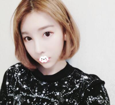 假體隆鼻修復(fù)效果