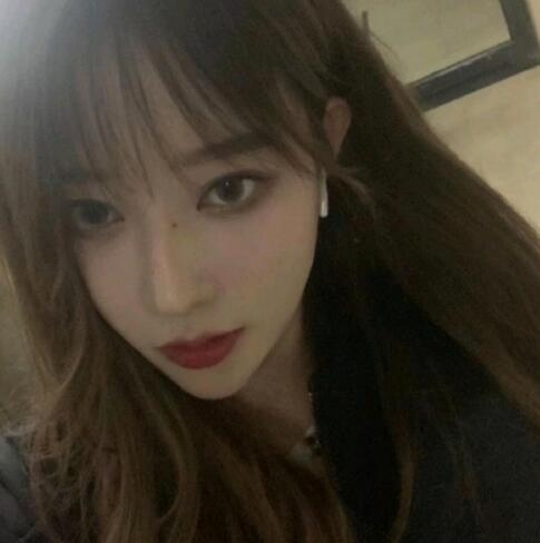 亳州華美整形美容醫(yī)院李劍醫(yī)生玻尿酸豐下巴案例效果分享