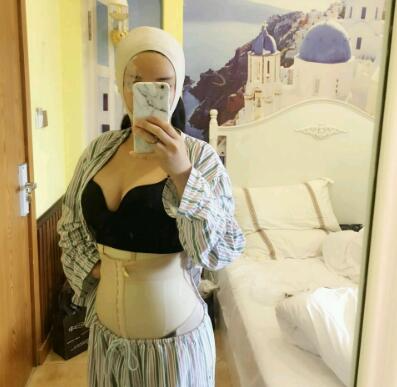 海南華美整形醫(yī)院王武醫(yī)生環(huán)形吸脂減肥手術(shù)案例效果圖