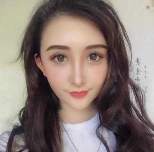 昆醫(yī)整形脂肪填充全臉效果