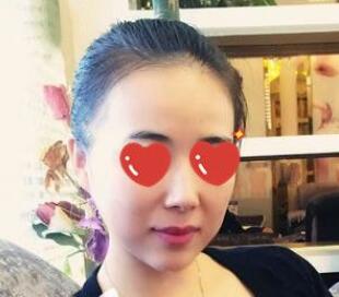 上海美萊醫(yī)療美容門(mén)診部伊維蘭隆下巴的優(yōu)勢(shì)