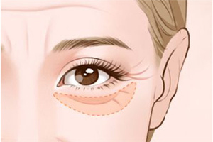 邵陽曹家醫(yī)療美容門診部激光祛眼袋