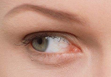 深圳芝華醫(yī)療美容門(mén)診部激光祛眼袋